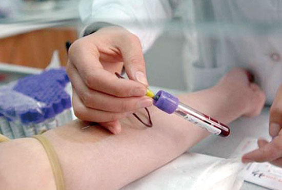 血液檢查應(yīng)注意5點以及紅細(xì)胞壽命測定介紹